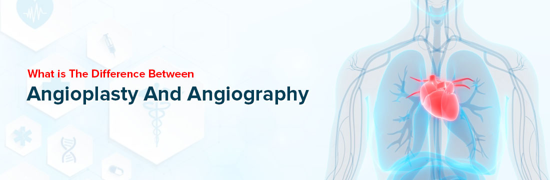 What is the Difference Between Angioplasty and Angiography